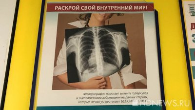 Уральские врачи будут использовать нейросети для борьбы с туберкулезом